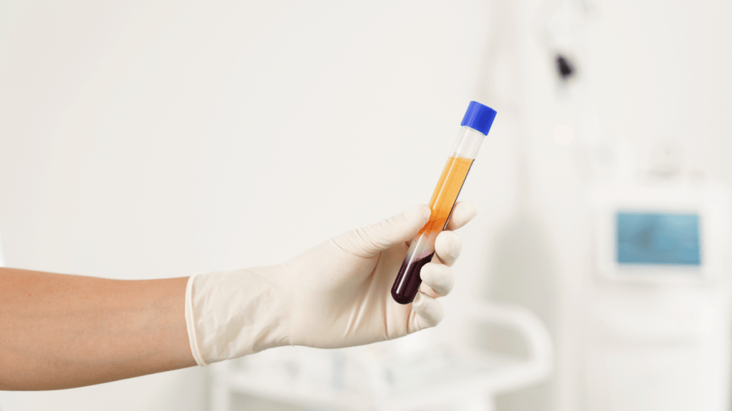 prp and stem cell therapy