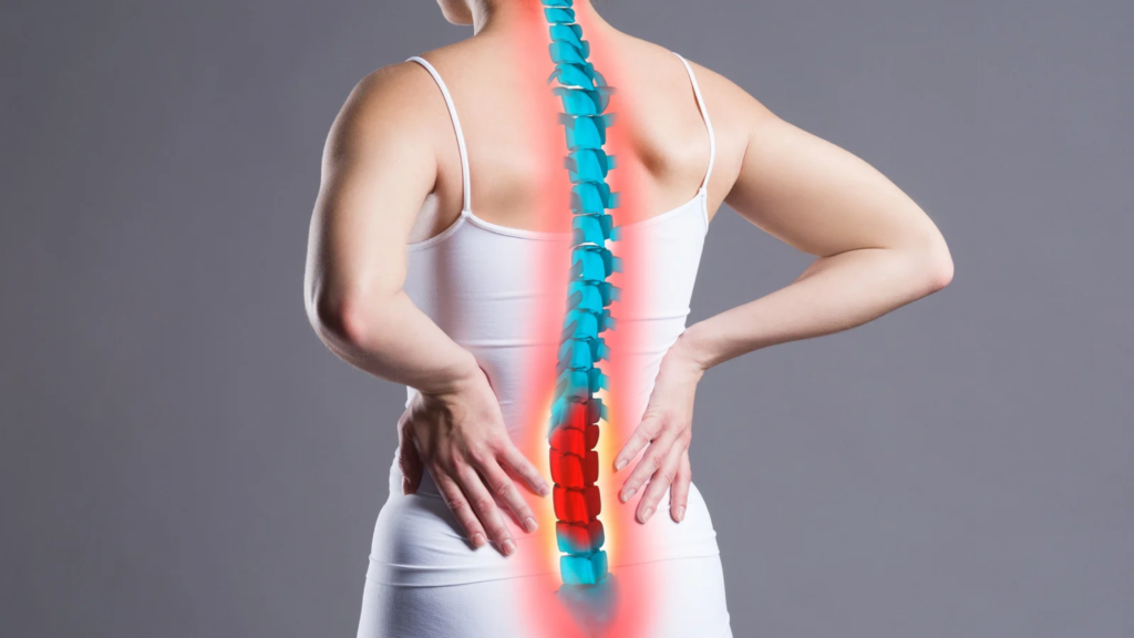 epidural steroid injections for sciatica and leg pain
